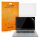 Sada 2 ochranných fólií na fotoaparát Kwmobile pro Lenovo Yoga 530 (14"), průhledná, plast, 51149.2