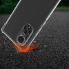 Pouzdro Kwmobile pro Huawei nova 9, silikonové, průhledné/černé, 57665.01