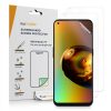 Sada 3 ks ochranných fólií Kwmobile pro OnePlus Nord N100, přední, Polymer, 57690.1