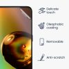Sada 3 ks ochranných fólií Kwmobile pro OnePlus Nord N100, přední, Polymer, 57690.1