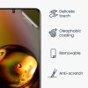 Sada 3 ks ochranných fólií Kwmobile pro Xiaomi Redmi Note 11 Pro/Redmi Note 11 Pro 5G, přední, Polymer, 57944.2